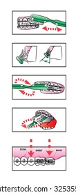 Orthodontic Illustrations