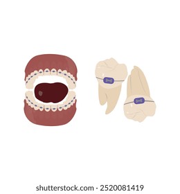 Anatomia Ortodôntica da Mandíbula: Dentes com Chaves