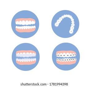 Orthodontic set of jaws with teeth while treatment. Brace and retainer on teeth. Flat vector illustration.