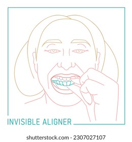 Orthodontic silicone trainer. Invisible braces retainer. Medical concept. Hand holding aligner. Under jaw. Horizontal poster. Editable vector illustration isolated on a white background.
