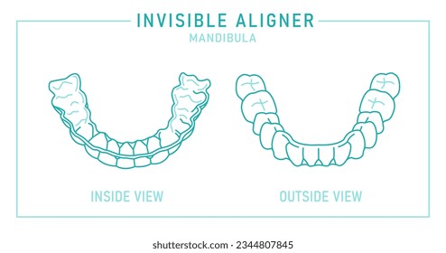 Entrenador de silicona ortodoncia. Alteración de llaves invisibles, fiador. Fuera, con vistas al interior. Bajo la mandíbula. Mandibula. Afiche médico horizontal. Ilustración vectorial editable aislada en un fondo blanco.