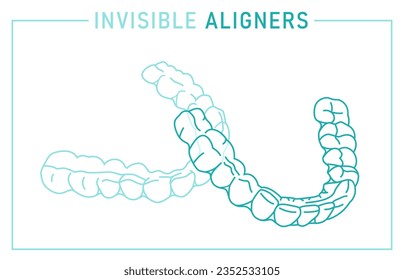 Entrenador de silicona ortodoncia. Alteración de llaves invisibles, fiador. Vista exterior. Debajo, mandíbula superior. Mandibula, Maxilla. Afiche médico horizontal. Ilustración vectorial editable en un fondo blanco.