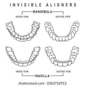 Orthodontic silicone trainer. Invisible braces aligner, retainer. Medical scheme in outline style. Outside, inside view. Upper jaw. Maxilla. Editable vector illustration isolated on a white background