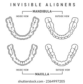 Entrenador de silicona ortodoncia. Alteración de llaves invisibles, fiador. Esquema médico de esquema. Fuera, con vistas al interior. Mano superior. Maxilla. Ilustración vectorial editable aislada en un fondo blanco