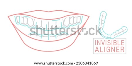 Orthodontic silicone trainer. Invisible braces aligner, retainer. Medical scheme. Outside view. Healthy smile. Horizontal poster. Editable vector illustration isolated on a white background.
