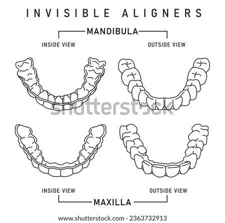 Orthodontic silicone trainer. Invisible braces aligner, retainer. Medical scheme in outline style. Outside, inside view. Upper jaw. Maxilla. Editable vector illustration isolated on a white background
