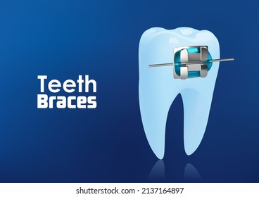 Orthodontic teeth or dental braces concept . illustration vector