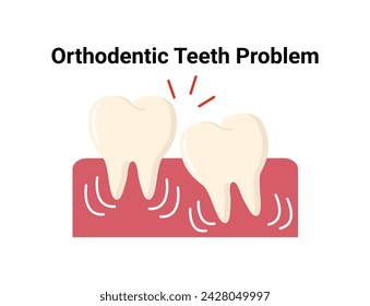 Orthodontic teeth flat illustration. Dentistry and orthodontics vector illustration. Dental clinic services, stomatology, dentistry, orthodontics, oral health care and hygiene vector.