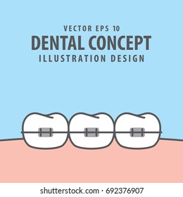 Orthodontic teeth illustration vector on blue background. Dental concept.