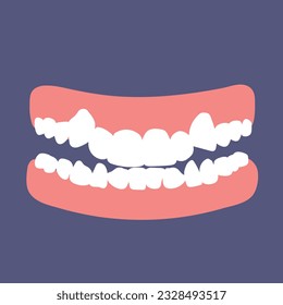 Orthodontic teeth problem crowding. Abnormal eruption. Double tooth. Opposite occlusion, open bite, crowded teeth, cavities, dentition. Vector illustration