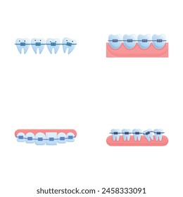 Iconos de tratamiento de ortodoncia conjunto de Vector de dibujos animados. Varios sistemas de ortesis en los dientes. Corrección de picadura