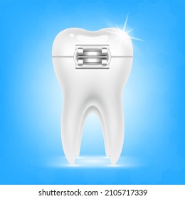 Orthodontic treatment style fashion beautiful. White teeth with metal brackets. Tooth braces isolated on a white background. Realistic 3D vector. Dental care health concept.