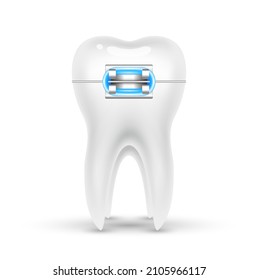 Orthodontic treatment style fashion beautiful blue. White teeth with metal brackets. Tooth braces isolated on a white background. Realistic 3D vector. Dental care health concept.