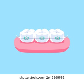 Orthodontics (braces) illustration vector design. Dental care concept.