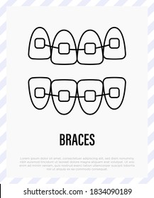 Orthodontics: braces, teeth correction. Dentistry. Thin line icon, vector illustration.