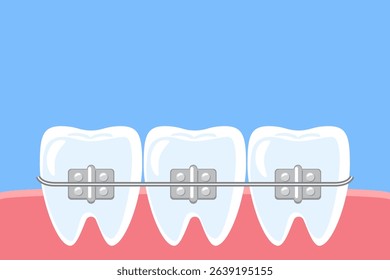 Orthodontics . Dental braces on teeth in oral cavity . Cartoon illustration . Vector .