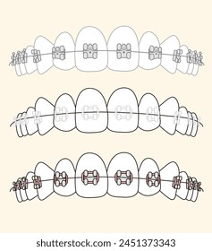 
Orthodontics different type of braces  - flat illustration 