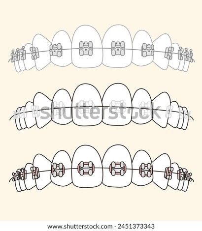 
Orthodontics different type of braces  - flat illustration 