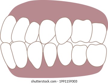 orthodontics illustrations on the ai