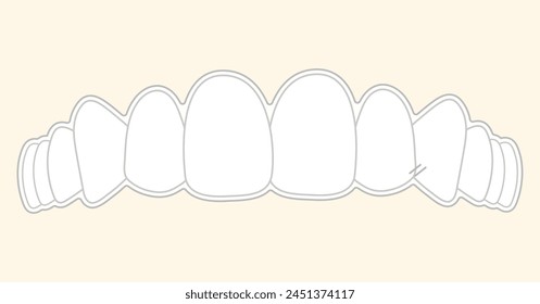 
Orthodontics invisible braces  - flat illustration 