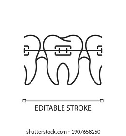 Orthodontics Linear Icon. Instruments For Dental Treatment. Family Orthodontics. Dental Braces. Thin Line Customizable Illustration. Contour Symbol. Vector Isolated Outline Drawing. Editable Stroke