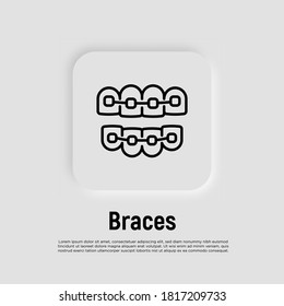 Orthodontics thin line icon. Braces, tooth correction. Dentistry. Vector illustration.