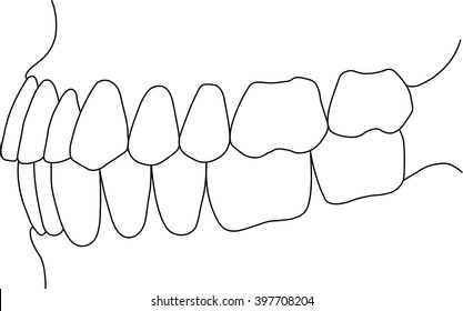 orthognathic dental occlusion on white background