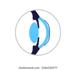 Orthokeratology fitted contact lens. Reshape the cornea to improve vision. Ortho k correct nearsightedness or myopia. Cornea and retina anatomy, human eye disease treatment flat vector illustration.