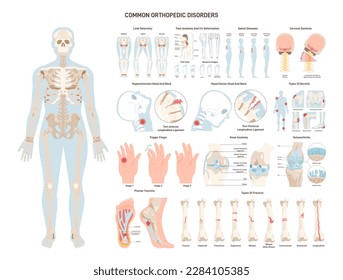 Orthopedic diseases set. Human skeleton, ligament and joints injuries. Painful medical conditions. Fractures, sprains and deformations of different body parts. Flat vector illustration