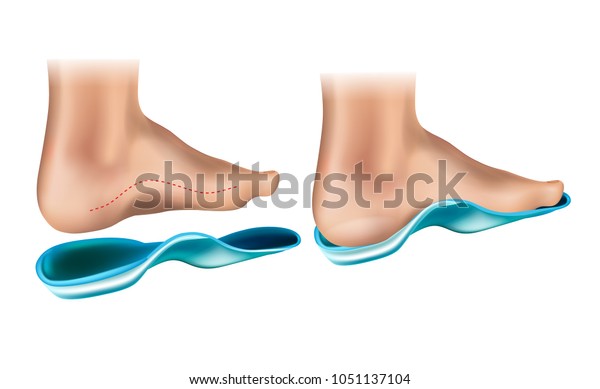 orthotic support