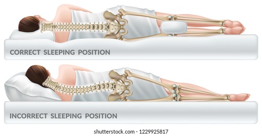Orthopedic pillow for knees. Correct and incorrect sleeping position legs. Isolated 3d realistic vector illustration. svg