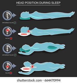 Orthopedic pillows for correct position of head during sleep. Vector illustration of the right and wrong posture of people lying on the back and side. Medical infographic for a healthy spine and neck. svg