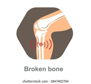 Orthopedics icon. bone fracture foot and leg and orthopedic disease
