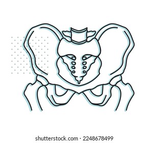 Osteoarthritis - Hip Joint - Stock Illustration as EPS 10 file