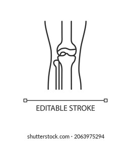 Osteoarthritis linear icon. Cartilage inflammation. Degenerative joint disease. Pain in knee. Thin line customizable illustration. Contour symbol. Vector isolated outline drawing. Editable stroke