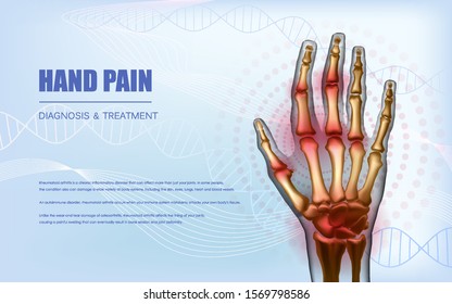 Osteoarthritis rheumatoid arthritis hand sore joints concept