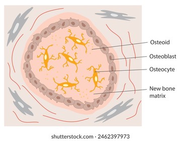 Osteoblasten, die von sezernierten Osteoiden verfangen werden, gehen anschließend in Osteozyten über.