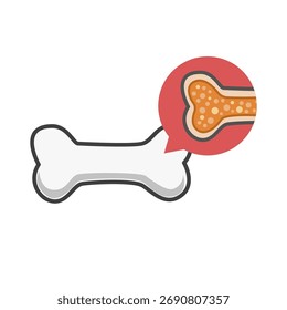 Osteoporosis. bone disease concept. vector illustration