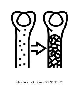 osteoporosis bone disease line icon vector. osteoporosis bone disease sign. isolated contour symbol black illustration
