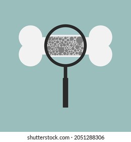 Osteoporosis bone with magnifying glass. Flat design vector illustration on isolated background.