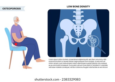 Osteoporosis disease concept. Systemic skeletal disorder, loss of bone mineral density. Increased risk of hip fracture in older men. Morbidity and mortality in the elderly, flat vector illustration