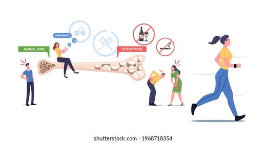 Osteoporosis, Health Care Concept. Tiny Male and Female Characters with Bones Disease Symptoms near Huge Bone Cross Section View with Normal and Porous Structure. Cartoon People Vector Illustration