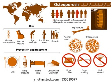 osteoporosis. health problems. medicine in medical infographics. elements and icons for design. concept. illness  illustration.