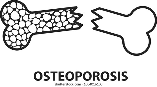 Osteoporosis Icon ,Bone Structure, Vector Illustration	