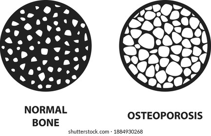 Osteoporosis icon ,Bone structure, vector illustration	