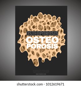 Osteoporosis Poster Template. Healthcare, medicine and early prevention concept. Vertical layout. Vector illustration with bone texture in beige, bronze, grey and white colors.