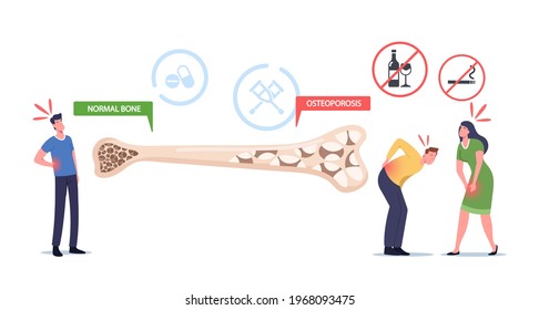 Osteoporosis, Symptoms, Health Care Concept. Tiny Male And Female Characters With Bones Disease Near Huge Bone Cross Section With Normal And Unhealthy Structure. Cartoon People Vector Illustration