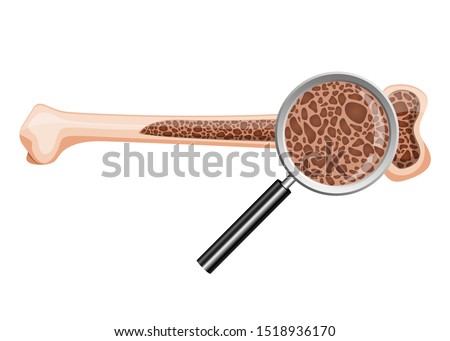 Osteoporosis vector design illustration isolated on white background