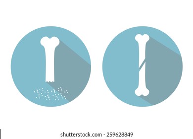 Osteoporosis.Infographics icons set.