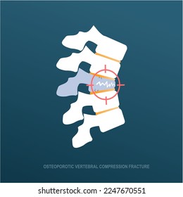 Osteoporotic vertebral compression fracture in eldery